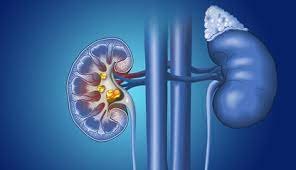 Best doctor for kidney in aurangabad