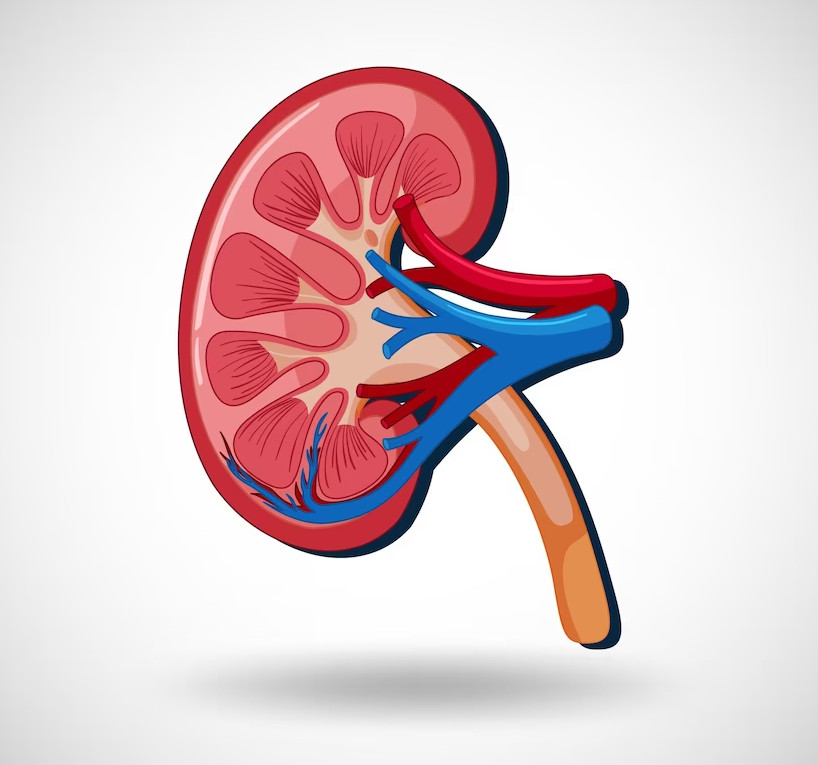 Kidney Stone Surgery in Aurangabad