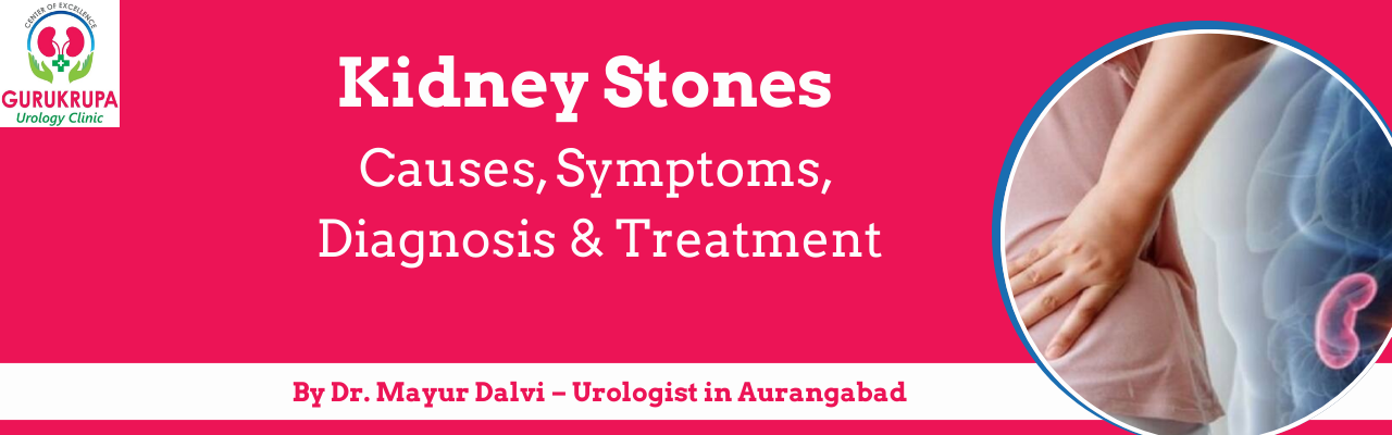 Kidney Stones: Causes, Symptoms, Diagnosis & Treatment