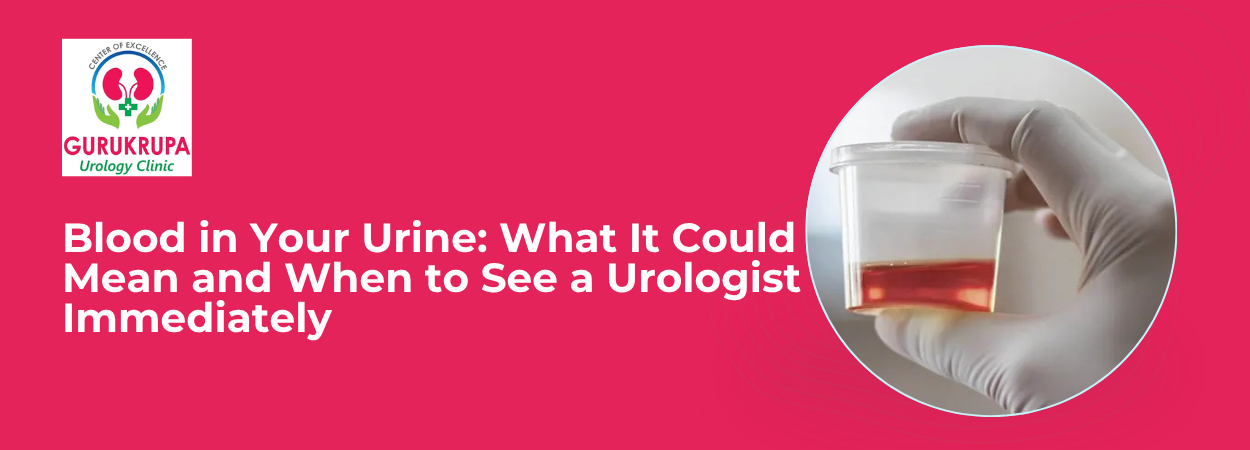 Blood in Your Urine: What It Could Mean and When to See a Urologist Immediately