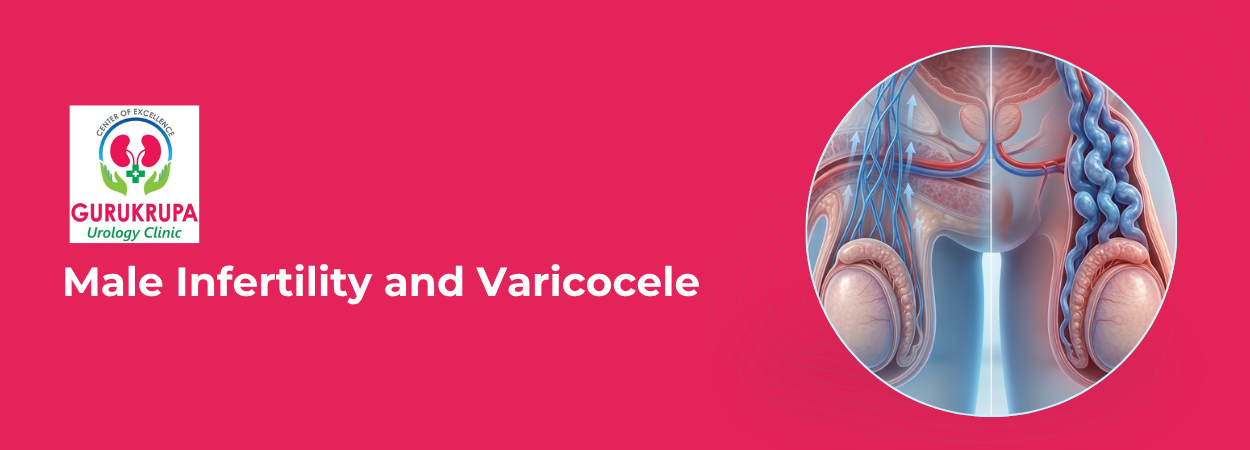 Male Infertility and Varicocele: What Every Man Should Know